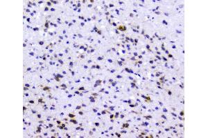 IHC analysis of Rad51 using anti-Rad51 antibody (ABIN6719396). (RAD51 anticorps)