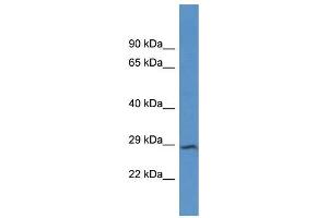 Western Blotting (WB) image for anti-Junctophilin 4 (JPH4) (C-Term) antibody (ABIN2788386) (Junctophilin 4 anticorps  (C-Term))