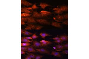 Immunofluorescence analysis of C6 cells using N-WASP/WASL Polyclonal Antibody (ABIN3016273, ABIN3016274, ABIN3016275, ABIN1683282 and ABIN6219682) at dilution of 1:100 (40x lens). (Neural Wiskott-Aldrich syndrome protein (WASL) (AA 1-250) anticorps)