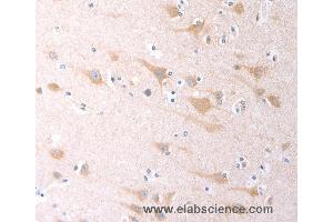 Immunohistochemistry of Human brain using SCGB1A1 Polyclonal Antibody at dilution of 1:60 (SCGB1A1 anticorps)