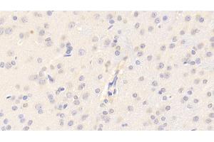 Detection of CYPA in Rat Cerebrum Tissue using Polyclonal Antibody to Cyclophilin A (CYPA)