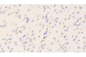 Detection of CYPA in Rat Cerebrum Tissue using Polyclonal Antibody to Cyclophilin A (CYPA) (PPIA anticorps  (AA 2-164))