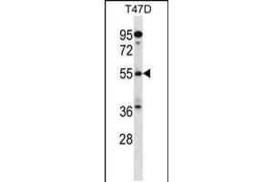 Western blot analysis in T47D cell line lysates (35ug/lane). (ARFGAP3 anticorps  (C-Term))