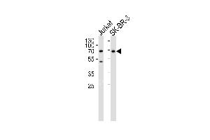 Western blot analysis of lysates from Jurkat,SK-BR-3 cell line (from left to right),using CD46 Antibody (C-term) (ABIN650982 and ABIN2840022).