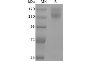 Western Blotting (WB) image for Leptin Receptor (LEPR) protein (mFc Tag) (ABIN7320895)