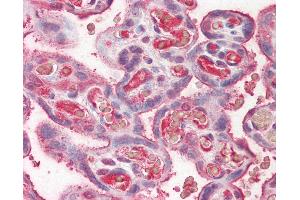 Anti-Ceruloplasmin antibody IHC of human placenta. (Ceruloplasmin anticorps)