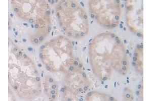 Detection of PFN2 in Human Kidney Tissue using Polyclonal Antibody to Profilin 2 (PFN2)