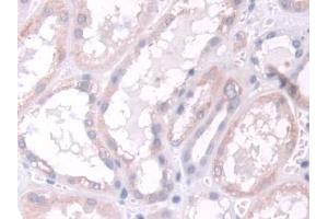 Detection of TPMT in Human Kidney Tissue using Polyclonal Antibody to Thiopurine Methyltransferase (TPMT)