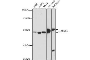 Western blot analysis of extracts of various cell lines, using  antibody (ABIN7265415) at 1:1000 dilution. (ACVR1 anticorps)