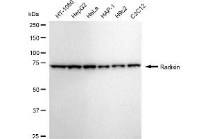 Western blotting analysis using Radixin antibody (ABIN7800123). (Recombinant Radixin anticorps)
