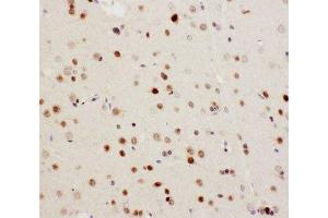 IHC-P: MEKK3 antibody testing of rat brain tissue (MAP3K3 anticorps  (N-Term))