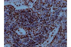 IHC image of ABIN7127789 diluted at 1:100 and staining in paraffin-embedded human lung tissue performed on a Leica BondTM system.