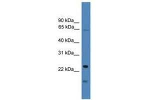 Image no. 1 for anti-TIMP Metallopeptidase Inhibitor 4 (TIMP4) (AA 101-150) antibody (ABIN6745268) (TIMP4 anticorps  (AA 101-150))