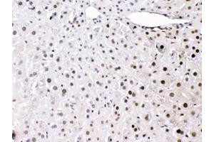 IHC testing of FFPE mouse liver tissue with HMGB1 antibody at 1ug/ml.