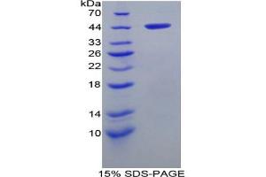 SDS-PAGE analysis of Rat aHSP Protein. (aHSP Protéine)