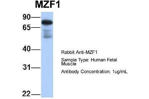 Host: Rabbit Target Name: MZF1 Sample Type: Human Fetal Muscle Antibody Dilution: 1. (MZF1 anticorps  (N-Term))