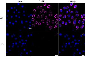Immunocytochemical staining of HeLa cells using G3BP1 antibody (ABIN7798816), 1:1,000), Top panel: wild-type (WT), Bottom panal: G3BP1 shRNA knockdown (KD).
