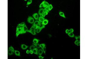 Figure:FITC staining on IHC-P Simple: Mcf7 cells (PKC iota anticorps  (AA 375-596))