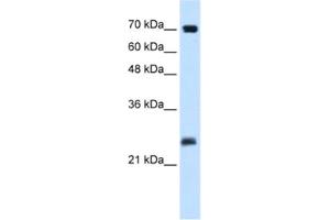 Western Blotting (WB) image for anti-SERTA Domain Containing 1 (SERTAD1) antibody (ABIN2460914) (SERTAD1 anticorps)
