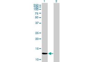 Western Blot analysis of ZNF343 expression in transfected 293T cell line by ZNF343 MaxPab polyclonal antibody. (ZNF343 anticorps  (AA 1-118))