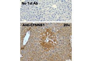 Immunohistochemistry (IHC) image for anti-Catenin, beta (CATNB) (C-Term) antibody (ABIN6254224)