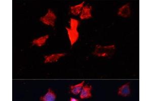 Immunofluorescence analysis of HeLa cells using CALM3 Polyclonal Antibody at dilution of 1:100. (Calmodulin 3 anticorps)