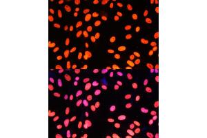 Immunofluorescence analysis of NIH-3T3 cells using ZNF581 Polyclonal Antibody (ABIN6128960, ABIN6150520, ABIN6150521 and ABIN6217055) at dilution of 1:100 (40x lens).
