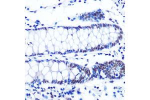 Immunohistochemistry of paraffin-embedded human colon using NRF1 Rabbit mAb (ABIN7269022) at dilution of 1:100 (40x lens).