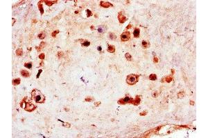 Immunohistochemistry of paraffin-embedded human placenta tissue using ABIN7150181 at dilution of 1:100 (MCM8 anticorps  (AA 1-67))