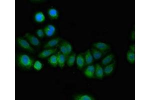 Immunofluorescent analysis of A549 cells using ABIN7146282 at dilution of 1:100 and Alexa Fluor 488-congugated AffiniPure Goat Anti-Rabbit IgG(H+L) (RCAN2 anticorps  (AA 88-197))