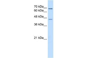WB Suggested Anti-ALDH3A2 Antibody Titration:  0. (ALDH3A2 anticorps  (C-Term))