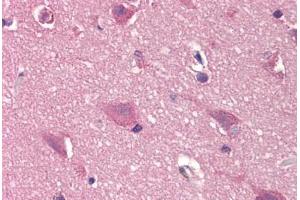 Human Brain, Cortex (formalin-fixed, paraffin-embedded) stained with DCK antibody ABIN299601 at 20 ug/ml followed by biotinylated goat anti-rabbit IgG secondary antibody ABIN481713, alkaline phosphatase-streptavidin and chromogen. (DCK anticorps  (N-Term))
