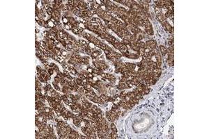 Immunohistochemical staining of human liver with ZCCHC24 polyclonal antibody  shows strong cytoplasmic positivity in hepatocytes while bile duct cells were negative at 1:200-1:500 dilution. (ZCCHC24 anticorps)