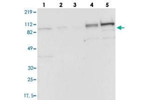 Western blot analysis of Lane 1: RT-4, Lane 2: EFO-21, Lane 3: A-431, Lane 4: Liver, Lane 5: Tonsil with CFB polyclonal antibody . (Complement Factor B anticorps)