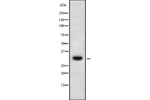 Western blot analysis of HoxD10 using K562 whole cell lysates (HOXD10 anticorps  (Internal Region))
