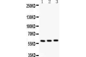 Anti-CYP11A1 antibody,  Western blotting All lanes: Anti CYP11A1 () at 0.