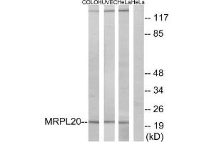 Western blot analysis of extracts from COLO cells, HUVEC cells and HeLa cells, using MRPL20 antibody. (MRPL20 anticorps  (C-Term))