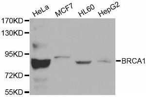Western blot analysis of extracts of various cell lines, using BRCA1 antibody (ABIN5970045). (BRCA1 anticorps)