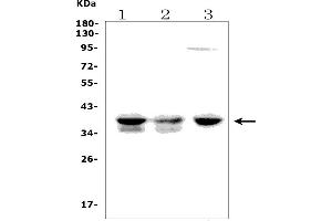 Western blot analysis of FDPS using anti-FDPS antibody (ABIN7601131).