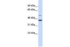 Western Blotting (WB) image for anti-Methylmalonic Aciduria (Cobalamin Deficiency) CblD Type, with Homocystinuria (MMADHC) antibody (ABIN2459880) (MMADHC anticorps)
