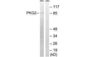 Western blot analysis of extracts from 293 cells, treated with anisomycin (25 μg/mL, 30 mins), using PKG2 (Ab-126) antibody. (PRKG2 anticorps  (Ser126))