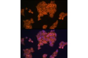 Immunofluorescence analysis of HeLa cells using PMP70/ Rabbit mAb (ABIN1683181, ABIN3018647, ABIN3018648 and ABIN7101638) at dilution of 1:100 (40x lens). (CX3CL1 anticorps)