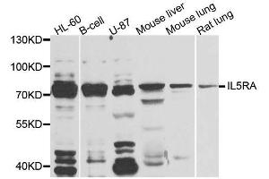 Western blot analysis of extracts of various cell lines, using IL5RA antibody (ABIN5996447) at 1/1000 dilution. (IL5RA anticorps)
