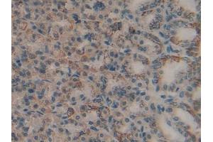 Detection of MMP9 in Rat Stomach Tissue using Polyclonal Antibody to Matrix Metalloproteinase 9 (MMP9)