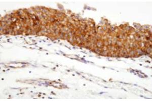 Immunohistochemistry (IHC) image for anti-Heat Shock Protein 90kDa alpha (Cytosolic), Class A Member 1 (HSP90AA1) (AA 1-732), (N-Term) antibody (ABIN317532) (HSP90AA1 anticorps  (N-Term))