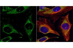 ICC/IF Image Endothelin 1 antibody [C1C3] detects Endothelin 1 protein at cytoplasm by immunofluorescent analysis.
