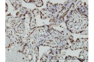 Immunoperoxidase of monoclonal antibody to HMGB2 on formalin-fixed paraffin-embedded human placenta. (HMGB2 anticorps  (AA 1-195))
