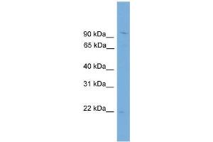 Human THP-1; WB Suggested Anti-TPPP3 Antibody Titration: 0. (TPPP3 anticorps  (N-Term))