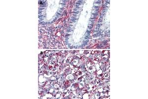 Immunohistochemical staining of formalin-fixed, paraffin-embedded human uterus (A) and human adrenal gland (B) tissue after heat-induced antigen retrieval. (Angiotensin II Type 2 Receptor anticorps  (Internal Region))