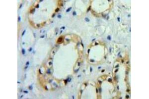 Used in DAB staining on fromalin fixed paraffin-embedded Kidney tissue (APP anticorps  (AA 18-286))